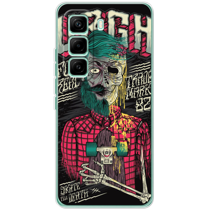 Чохол BoxFace Infinix Hot 60 Pro 