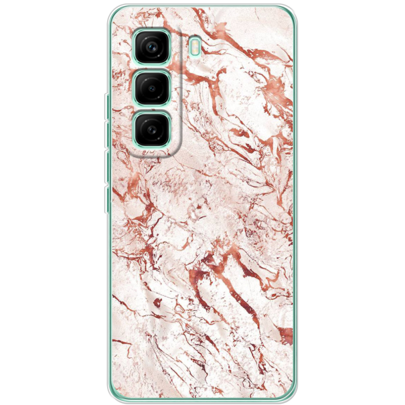 Чохол BoxFace Infinix Hot 60 Pro 