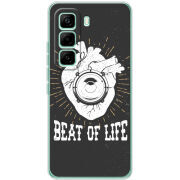 Чохол BoxFace Infinix Hot 60 Pro 