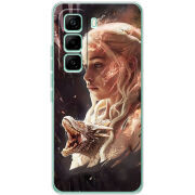 Чохол BoxFace Infinix Hot 60 Pro 