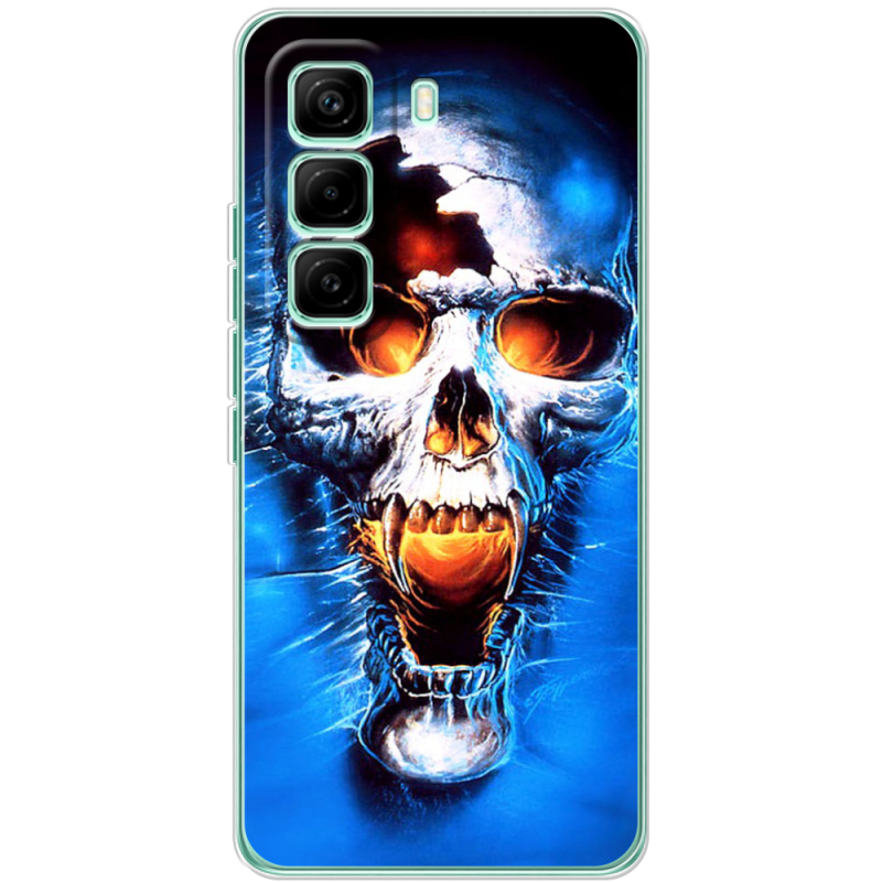 Чохол BoxFace Infinix Hot 60 Pro 