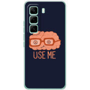 Чохол BoxFace Infinix Hot 60 Pro 