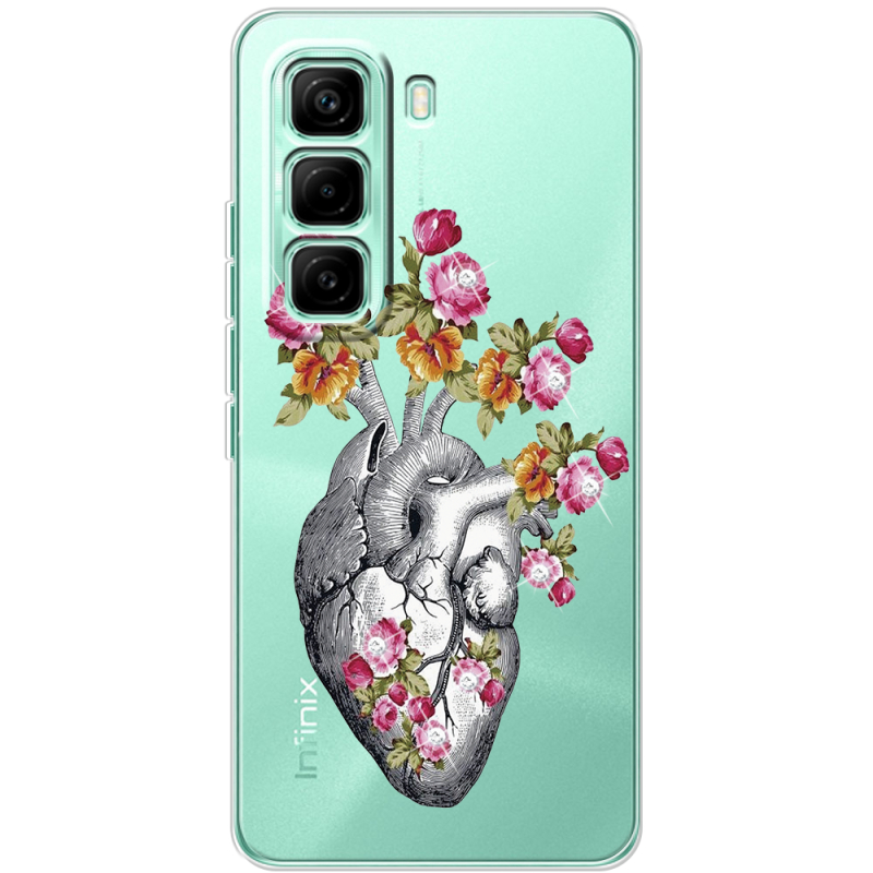 Чохол зі стразами Infinix Hot 60 Pro Heart