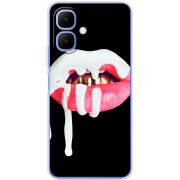 Чохол BoxFace Tecno Go 2 