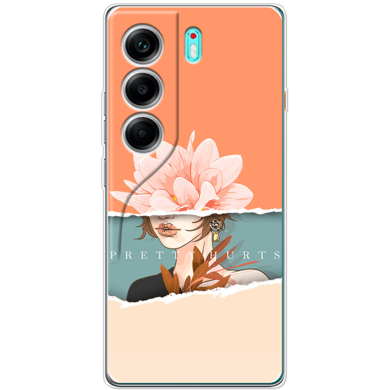 Чохол BoxFace Tecno Camon 40 