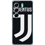 Чохол BoxFace Tecno Camon 40 FC J