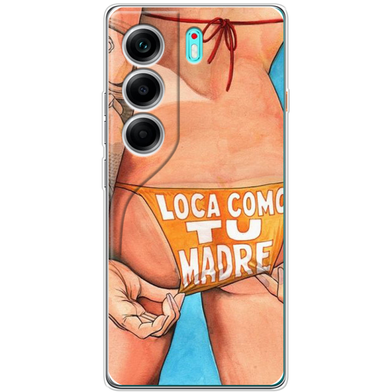 Чохол BoxFace Tecno Camon 40 