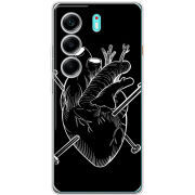 Чохол BoxFace Tecno Camon 40 