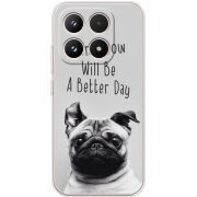 Чохол BoxFace Xiaomi 17 