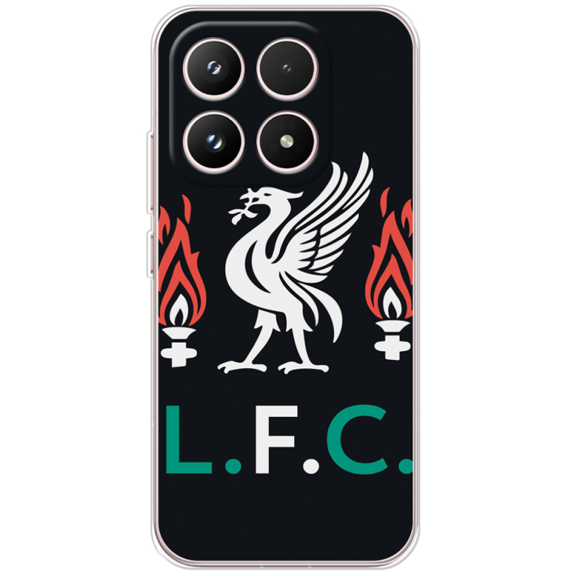 Чохол BoxFace Xiaomi 17 L. F. C.