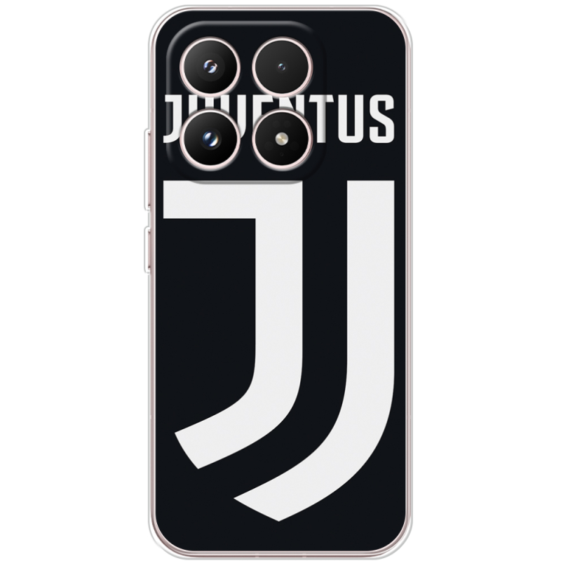 Чохол BoxFace Xiaomi 17 FC J