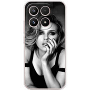 Чохол BoxFace Xiaomi 17 