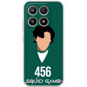 Чохол BoxFace Xiaomi 17 siquid game 456