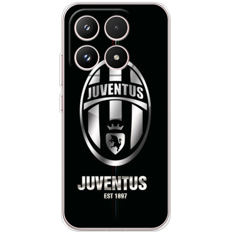 Чохол BoxFace Xiaomi 17 