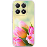 Чохол BoxFace Xiaomi 17 Bouquet of Tulips