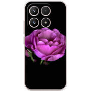 Чохол BoxFace Xiaomi 17 