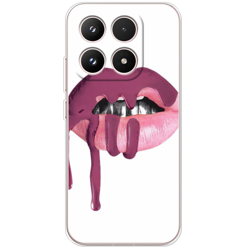 Чохол BoxFace Xiaomi 17 