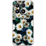 Чохол BoxFace Xiaomi 17 