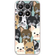 Чохол BoxFace Xiaomi 17 