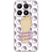 Чохол BoxFace Xiaomi 17 