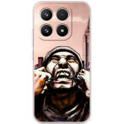 Чохол BoxFace Xiaomi 17 