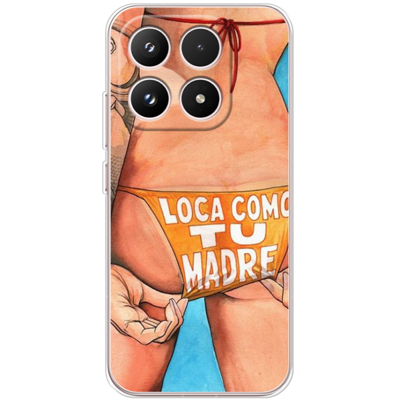 Чохол BoxFace Xiaomi 17 