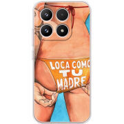 Чохол BoxFace Xiaomi 17 