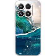 Чохол BoxFace Xiaomi 17 