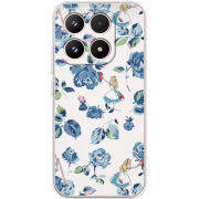 Чохол BoxFace Xiaomi 17 