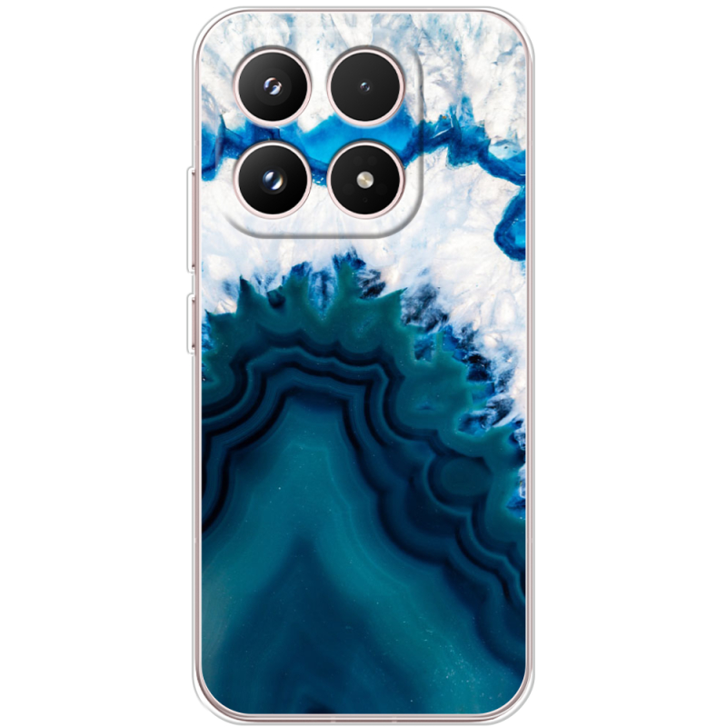 Чохол BoxFace Xiaomi 17 