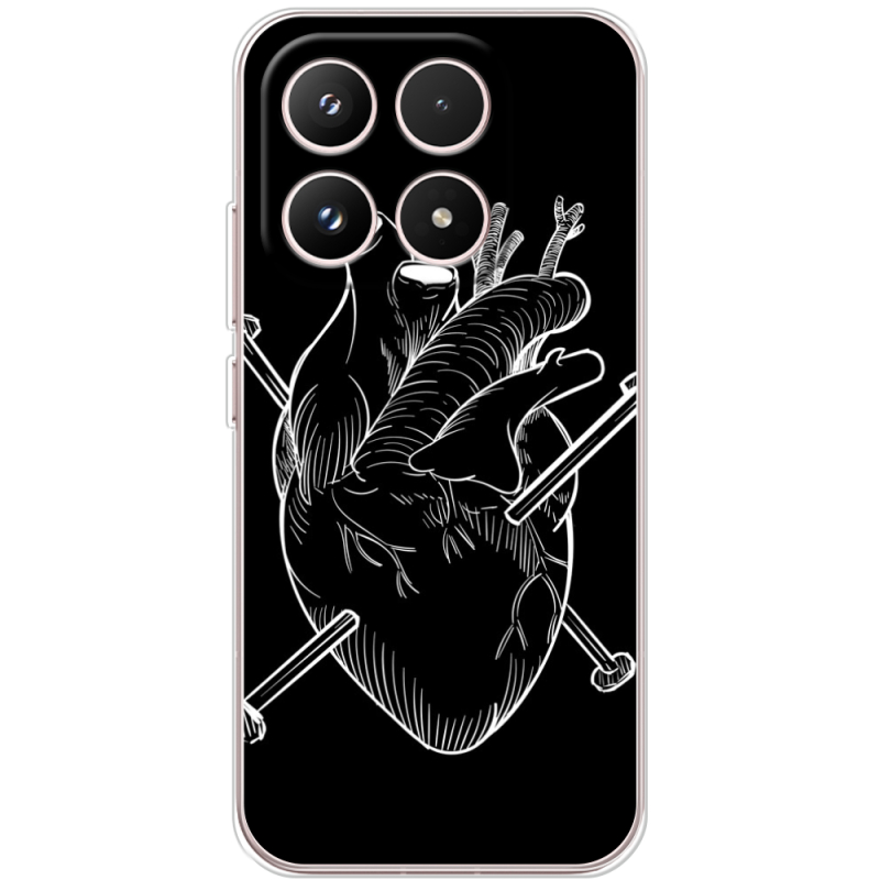 Чохол BoxFace Xiaomi 17 