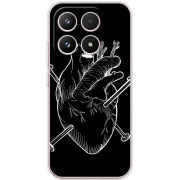 Чохол BoxFace Xiaomi 17 