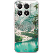 Чохол BoxFace Xiaomi 17 