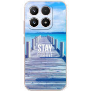 Чохол BoxFace Xiaomi 17 