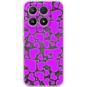 Чохол BoxFace Xiaomi 17 