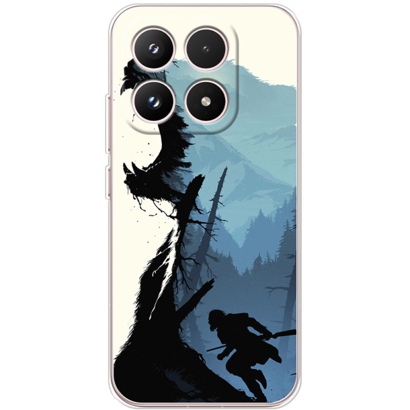 Чохол BoxFace Xiaomi 17 