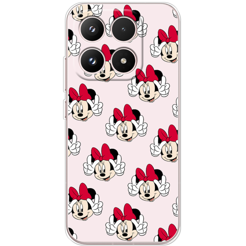 Чохол BoxFace Xiaomi 17 