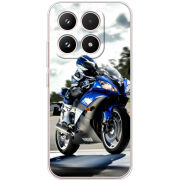 Чохол BoxFace Xiaomi 17 