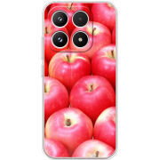 Чохол BoxFace Xiaomi 17 