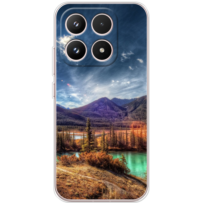 Чохол BoxFace Xiaomi 17 