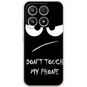 Чохол BoxFace Xiaomi 17 Don't Touch my Phone