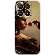 Чохол BoxFace Xiaomi 17 