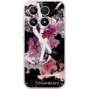 Чохол BoxFace Xiaomi 17 