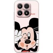 Прозорий чохол BoxFace Xiaomi 17 Mister M