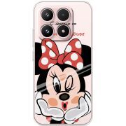 Прозорий чохол BoxFace Xiaomi 17 Lady M