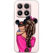 Прозорий чохол BoxFace Xiaomi 17 Mouse Mommy