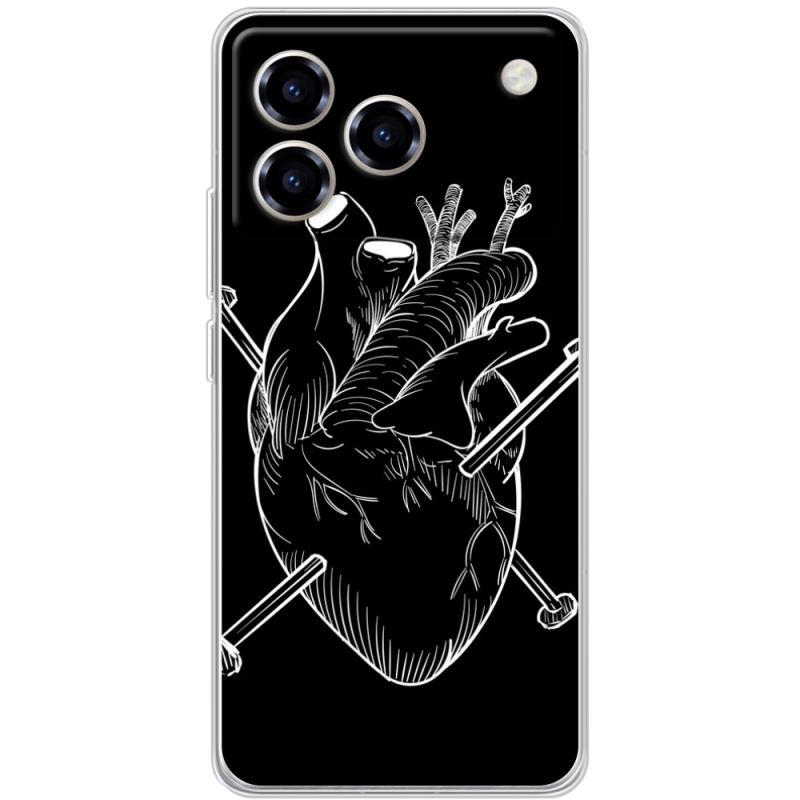 Чохол BoxFace ZTE Blade A76 4G 