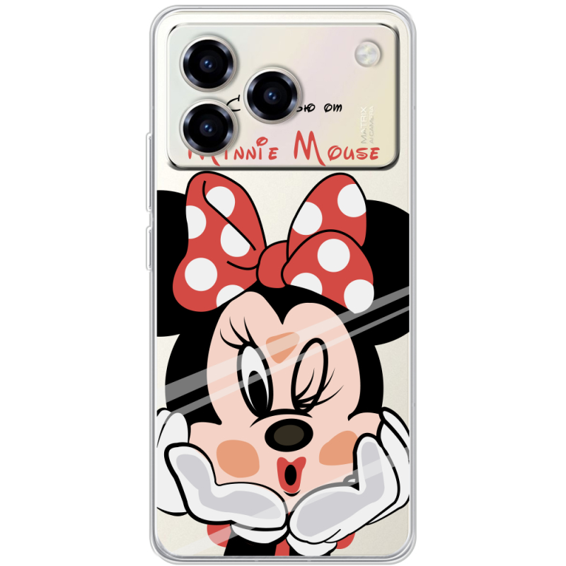 Прозорий чохол BoxFace ZTE Blade A76 4G Lady M