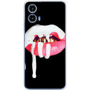 Чохол BoxFace Motorola Moto G35 