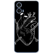 Чохол BoxFace Motorola Moto G35 